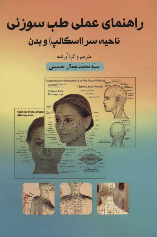 کتاب راهنمای عملی طب سوزنی ناحیه سروبدن